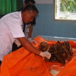 Pegawai RSUD Kartini memriksa tulang belulang yang di temukan di Desa Pelang lor kemarin.